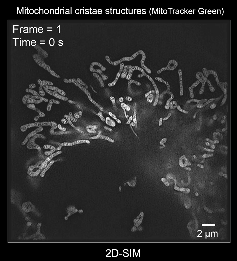 SN2N denoising of 2D-SIM microscopy