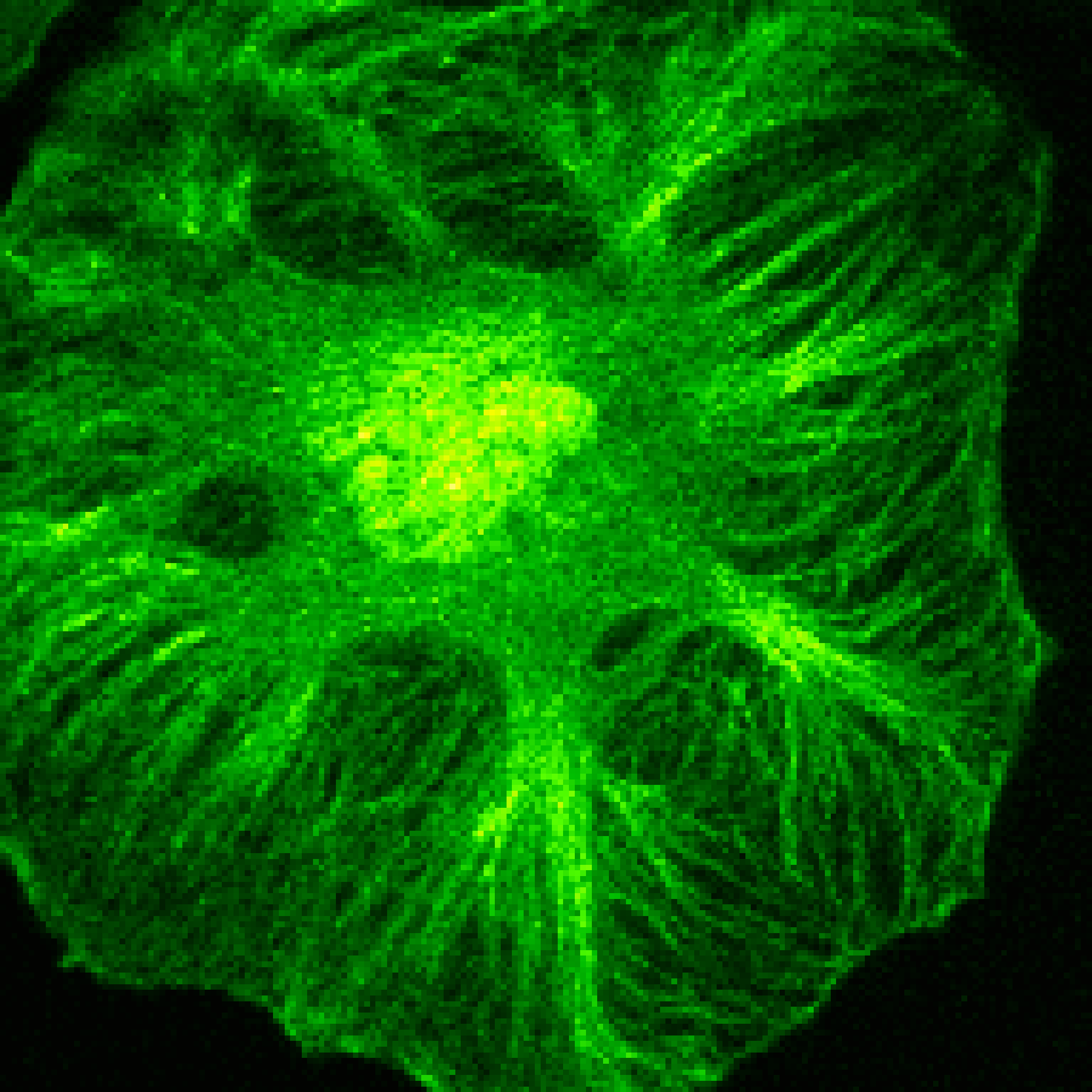 Conventional two-dimensional ECL image