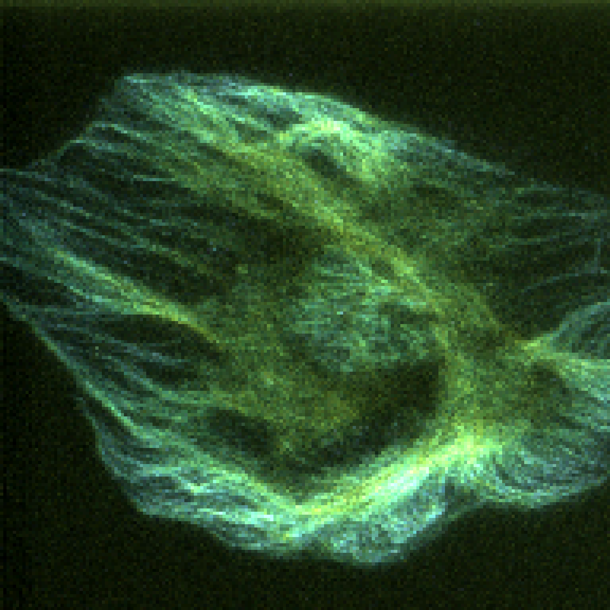 Conventional three-dimensional ECL image
