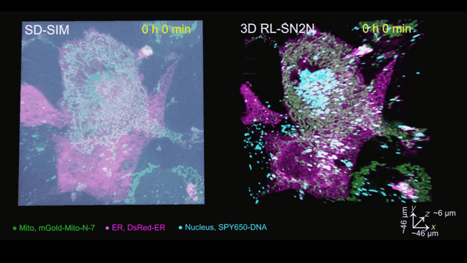 Five-dimensional SN2N microscopy reconstruction