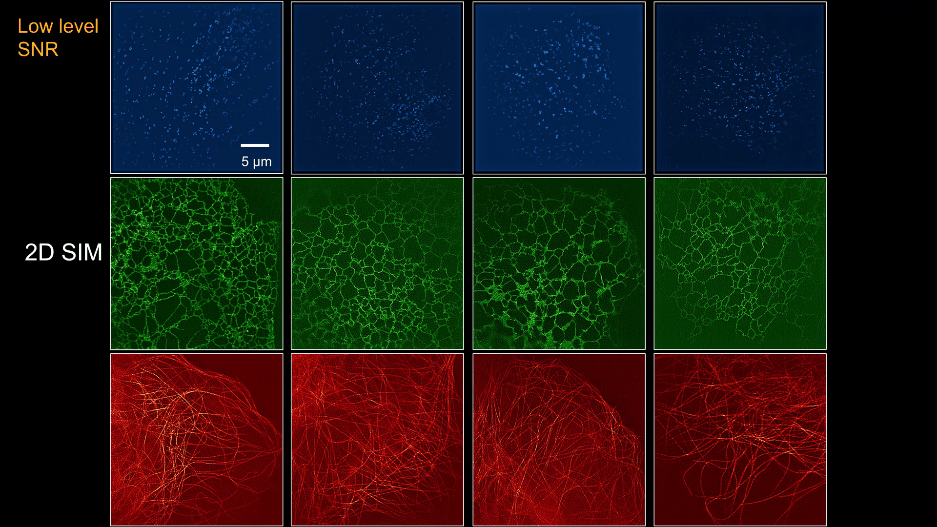SN2N denoising of GI-SIM microscopy