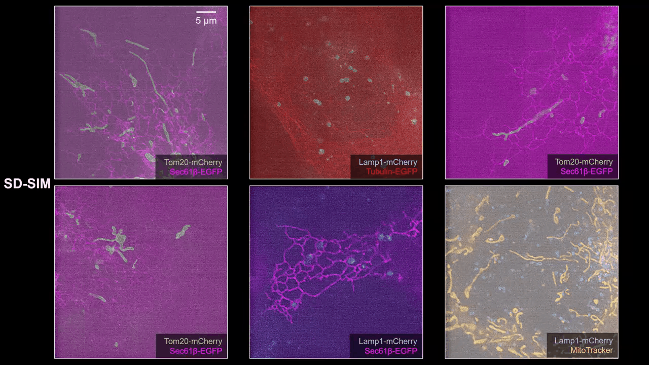 SN2N microscopy denoising comparison