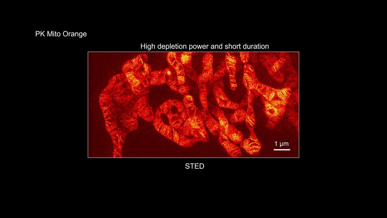 SN2N denoising of STED microscopy